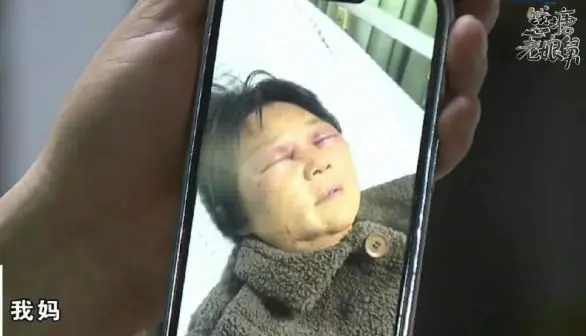 妻子打断婆婆4根肋骨,男子承认妻子多次动手但情有可原:母亲找了新老伴不带娃,要么就给钱补贴;姐姐:母亲苦了一辈子,支持她的决定